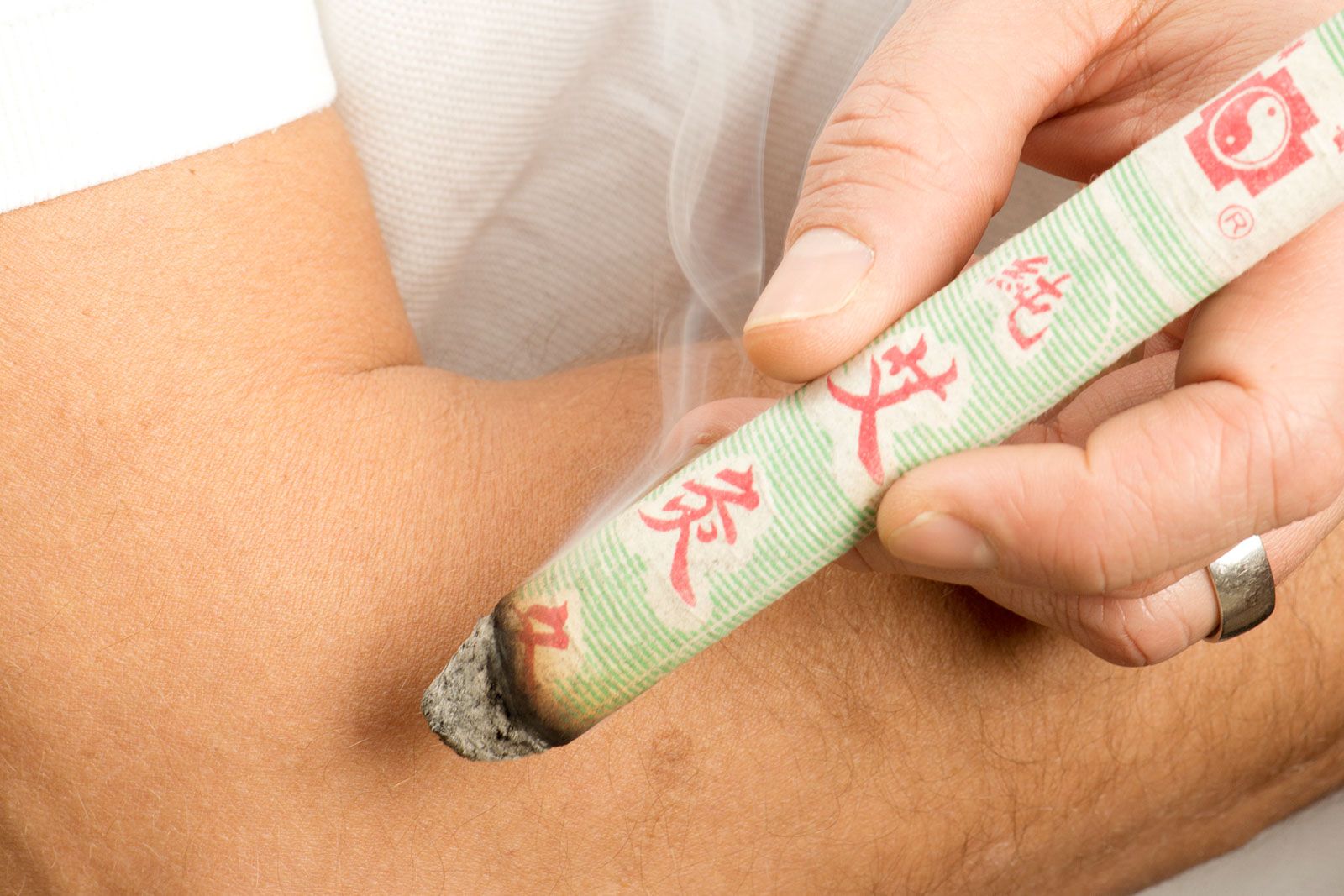 Moxibustion 灸法